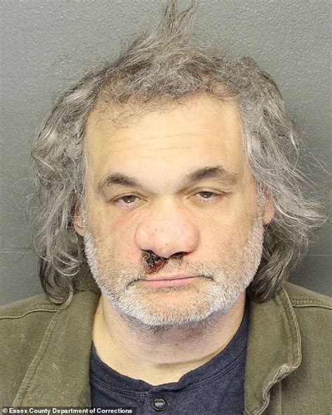 artie lange nose|Comedian Artie Lange shares photo of nose after 3 decades of